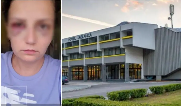 Advokati nasilnika i vlasnika hotela Jablanica ponudili nagodbu povrijeđenoj Enisi Klepa (28)