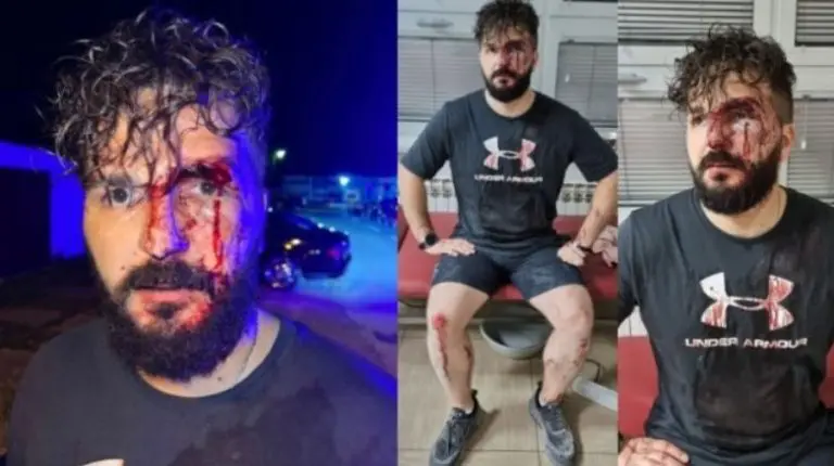 U Brčkom brutalno pretučen novinar Mirza Dervišević
