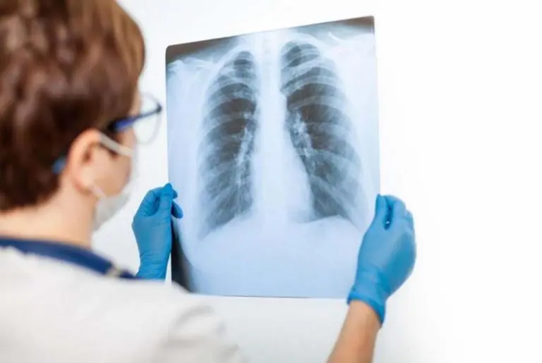 Revolucija u medicini; Zašto nepušači oboljevaju od raka pluća?