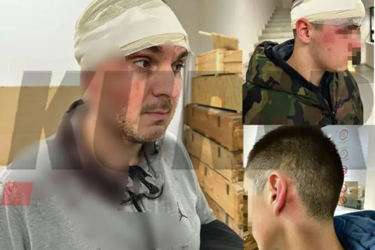 MALOLJETNICI PREBILI ŠTANGLAMA ČUVENOG BEOGRADSKOG DOKTORA I SINOVE! Sve je počelo jednim POZIVOM IZ ŠKOLE