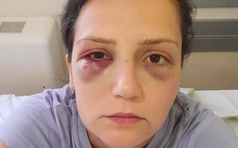 Enisa Klepo za Buku: Moramo stati u kraj nasilju