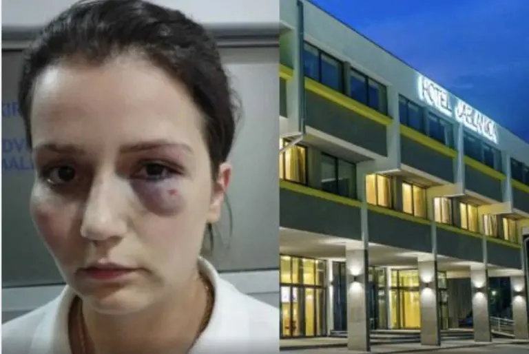 Pretučena radnica hotela “Jablanica”: Vlasnik hotela me brutalno me tukao po glavi, imam prelome