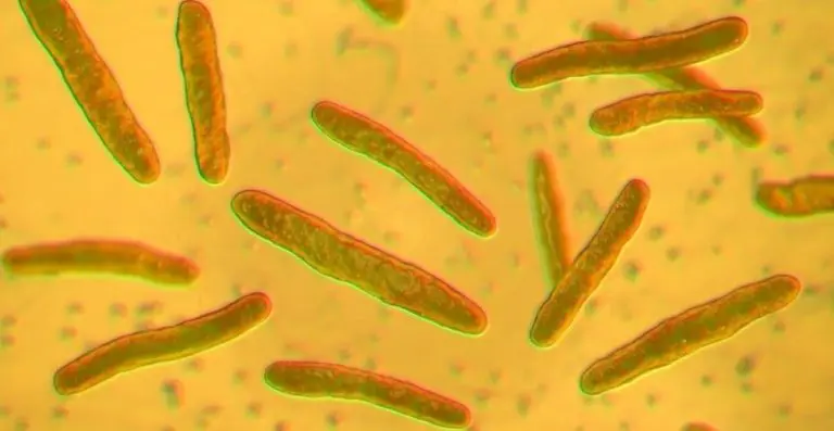 Vratila se jedna od najstarijih opakih bolesti, stručnjaci zabrinuti: ‘Nije nam jasno kako su se neki zarazili!‘