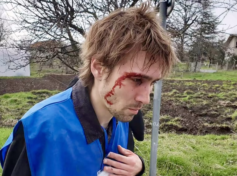 Stravično iskustvo studenta Lazara tokom izbornog dana u Boru: “Maskirani batinaši iz crnog džipa jurili su me dok nisam upao u Timok, a onda me tukli i slomili mi kosti”